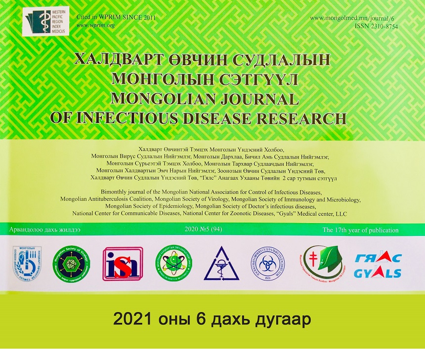 Setguul_zarlal_202103031